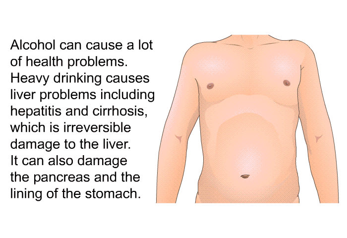 Alcohol can cause a lot of health problems. Heavy drinking causes liver problems including hepatitis and cirrhosis, which is irreversible damage to the liver. It can also damage the pancreas and the lining of the stomach.