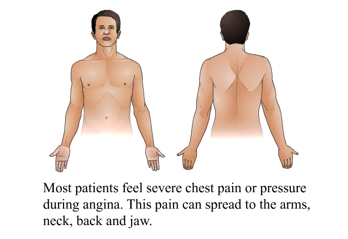 Most patients feel severe chest pain or pressure during angina. This pain can spread to the arms, neck, back and jaw.