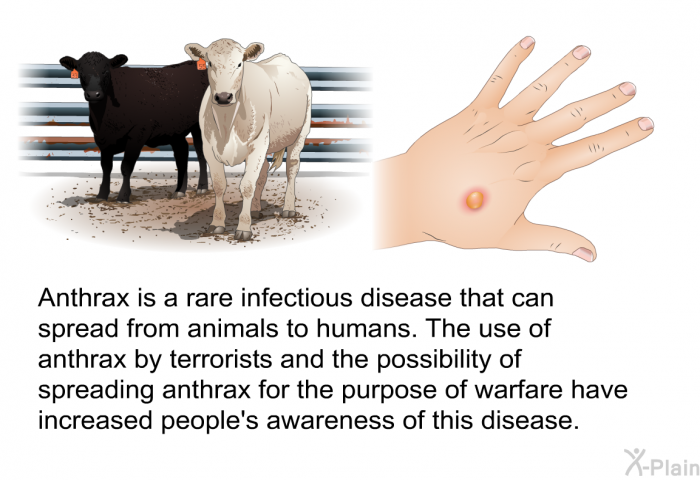 Anthrax is a rare infectious disease that can spread from animals to humans. The use of anthrax by terrorists and the possibility of spreading anthrax for the purpose of warfare have increased people's awareness of this disease.