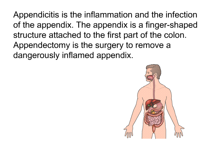 Appendicitis is the inflammation and the infection of the appendix. The appendix is a finger-shaped structure attached to the first part of the colon. Appendectomy is the surgery to remove a dangerously inflamed appendix.