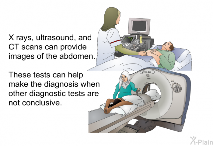 X rays, ultrasound, and CT scans can produce images of the abdomen. These tests can help make the diagnosis when other diagnostic tests are not conclusive.
