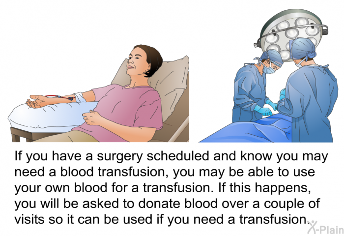 If you have a surgery scheduled and know you may need a blood transfusion, you may be able to use your own blood for a transfusion. If this happens, you will be asked to donate blood over a couple of visits so it can be used if you need a transfusion.
