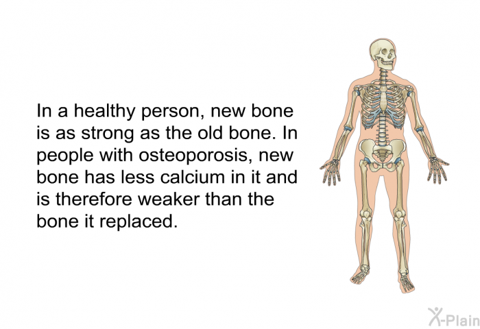 In a healthy person, new bone is as strong as the old bone. In people with osteoporosis, new bone has less calcium in it and is therefore weaker than the bone it replaced.