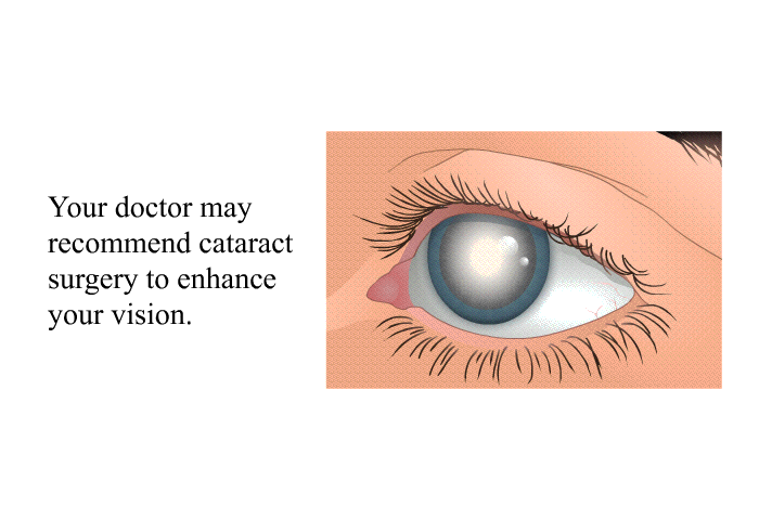 Your doctor may recommend cataract surgery to enhance your vision.