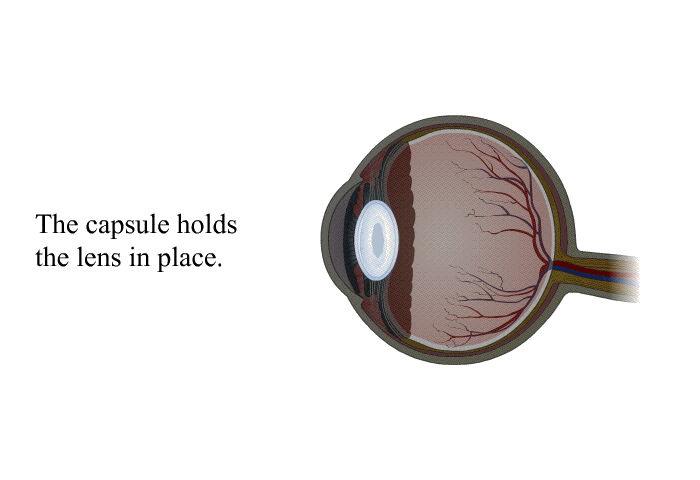The capsule holds the lens in place.