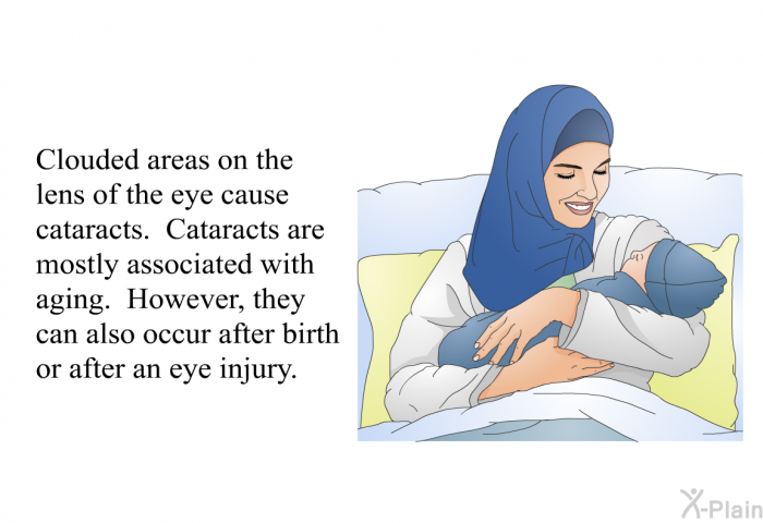 Clouded areas on the lens of the eye cause cataracts. Cataracts are mostly associated with aging. However, they can also occur after birth or after an eye injury.