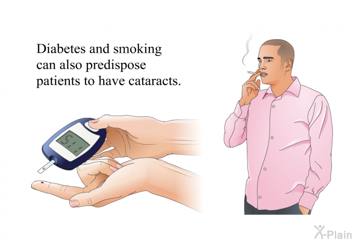 Diabetes and smoking can also predispose patients to have cataracts.