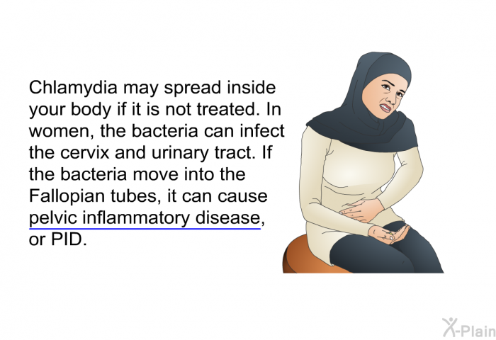 Chlamydia may spread inside your body if it is not treated. In women, the bacteria can infect the cervix and urinary tract. If the bacteria move into the Fallopian tubes, it can cause pelvic inflammatory disease, or PID.