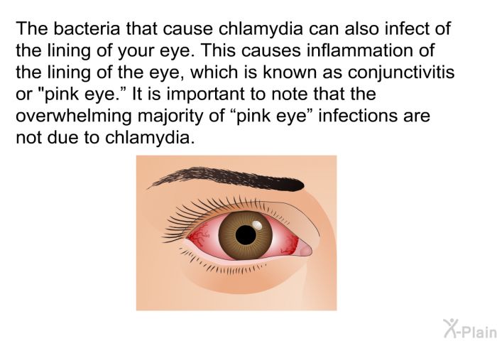 The bacteria that cause chlamydia can also infect of the lining of your eye. This causes inflammation of the lining of the eye, which is known as conjunctivitis or "pink eye.” It is important to note that the overwhelming majority of “pink eye” infections are not due to chlamydia.