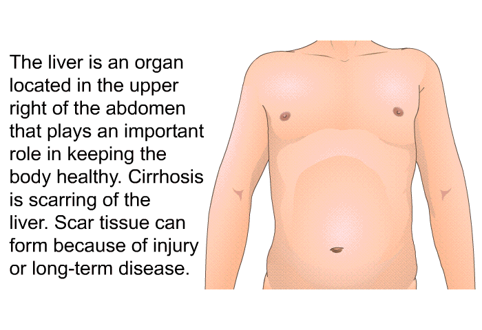The liver is an organ located in the upper right of the abdomen that plays an important role in keeping the body healthy. Cirrhosis is scarring of the liver. Scar tissue can form because of injury or long-term disease.