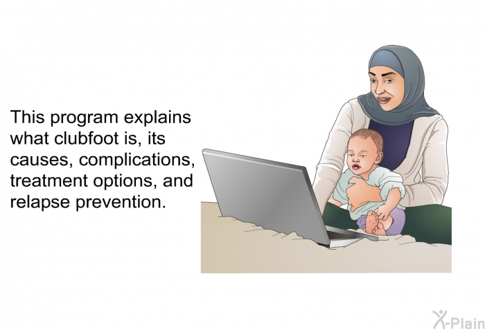 This health information explains what clubfoot is, its causes, complications, treatment options, and relapse prevention.