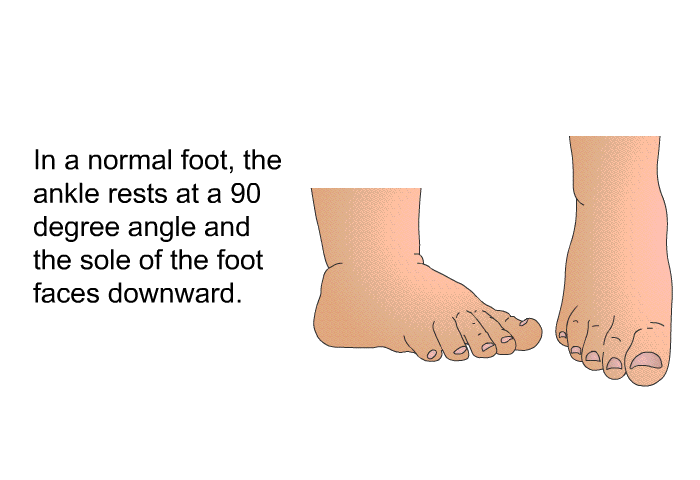 In a normal foot, the ankle rests at a 90 degree angle and the sole of the foot faces downward.