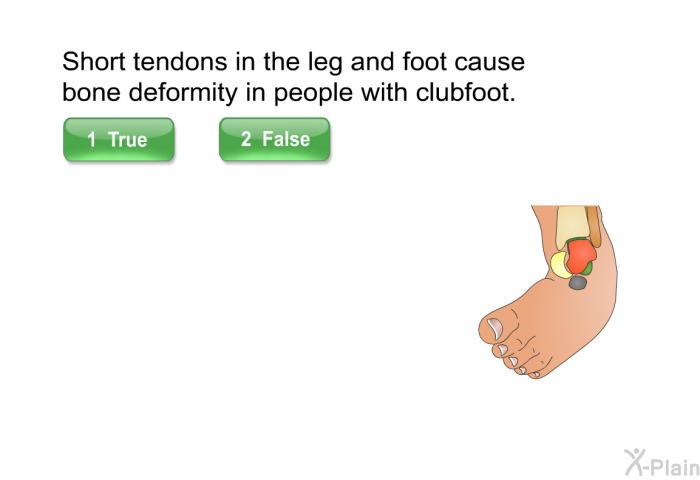 Short tendons in the leg and foot cause bone deformity in people with clubfoot.