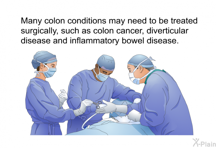 Many colon conditions may need to be treated surgically, such as colon cancer, diverticular disease and inflammatory bowel disease.