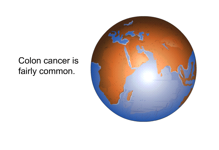 Colon cancer is fairly common.