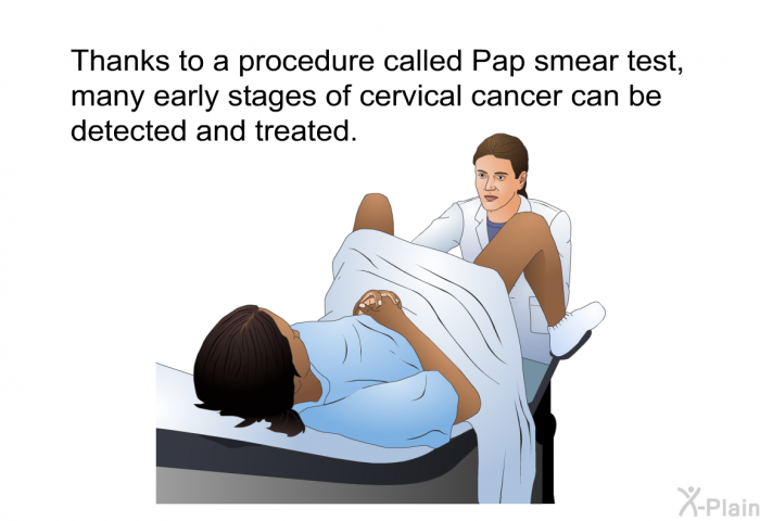 Thanks to a procedure called Pap smear test, many early stages of cervical cancer can be detected and treated.