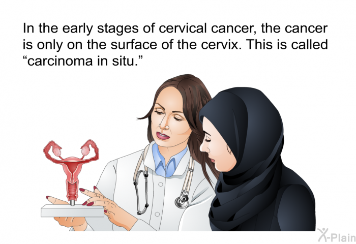 In the early stages of cervical cancer, the cancer is only on the surface of the cervix. This is called “carcinoma in situ.”