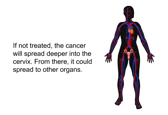 If not treated, the cancer will spread deeper into the cervix. From there, it could spread to other organs.