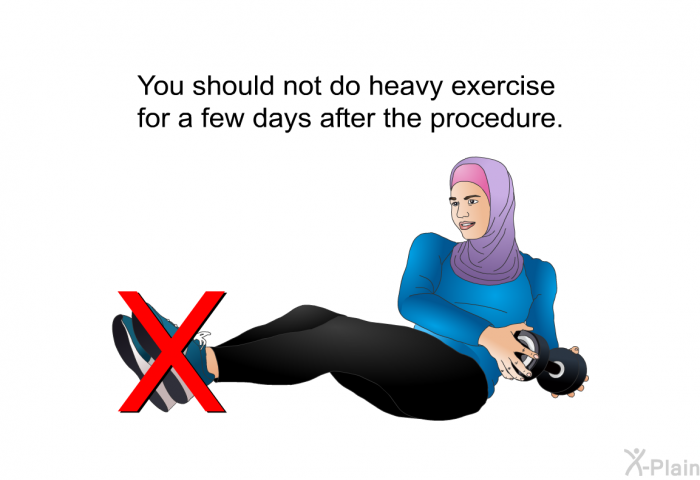 You should not do heavy exercise for a few days after the procedure.