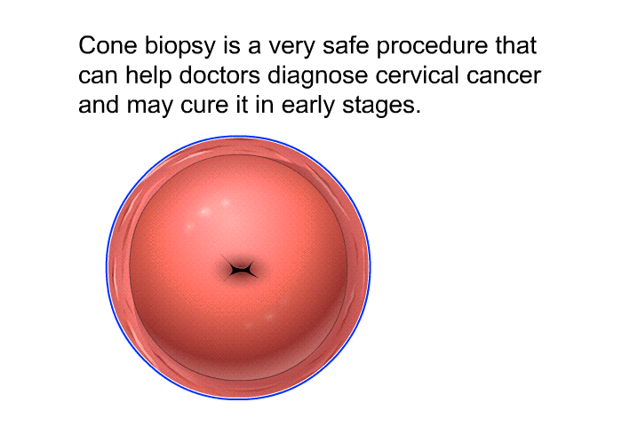 Cone biopsy is a very safe procedure that can help doctors diagnose cervical cancer and may cure it in early stages.