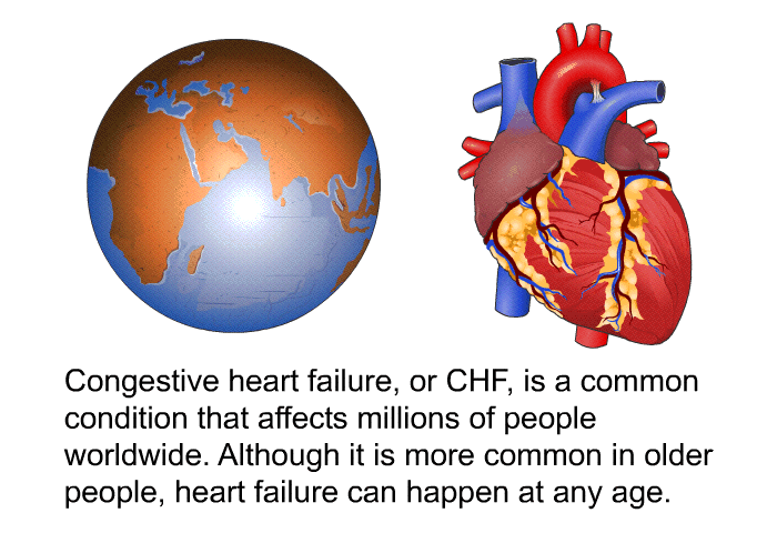 Congestive heart failure, or CHF, is a common condition that affects millions of people worldwide. Although it is more common in older people, heart failure can happen at any age.