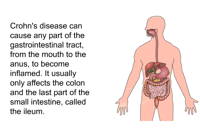 Crohn's disease can cause any part of the gastrointestinal tract, from the mouth to the anus, to become inflamed. It usually only affects the colon and the last part of the small intestine, called the ileum.