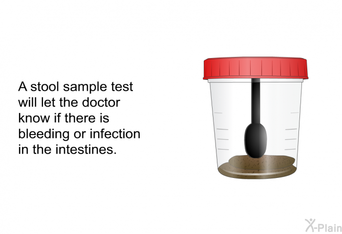 A stool sample test will let the doctor know if there is bleeding or infection in the intestines.