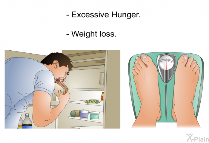 Excessive Hunger. Weight loss.