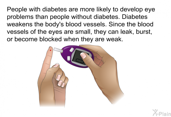 People with diabetes are more likely to develop eye problems than people without diabetes. Diabetes weakens the body's blood vessels. Since the blood vessels of the eyes are small, they can leak, burst, or become blocked when they are weak.