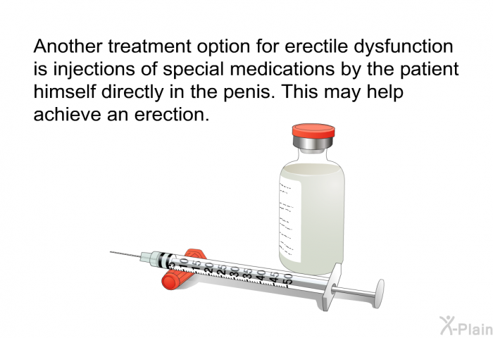 Another treatment option for erectile dysfunction is injections of special medications by the patient himself directly in the penis. This may help achieve an erection.