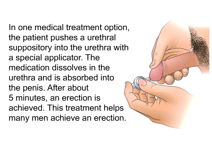 In one medical treatment option, the patient pushes a urethral suppository into the urethra with a special applicator. The medication dissolves in the urethra and is absorbed into the penis. After about 5 minutes, an erection is achieved. This treatment helps many men achieve an erection.