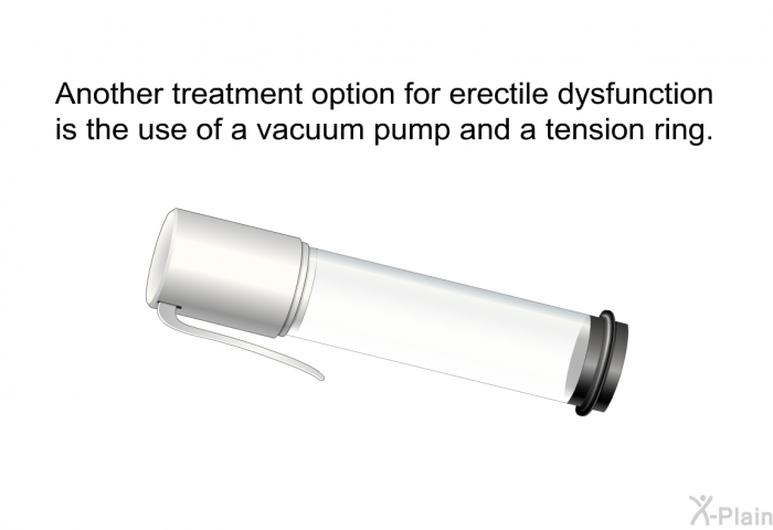 Another treatment option for erectile dysfunction is the use of a vacuum pump and a tension ring.