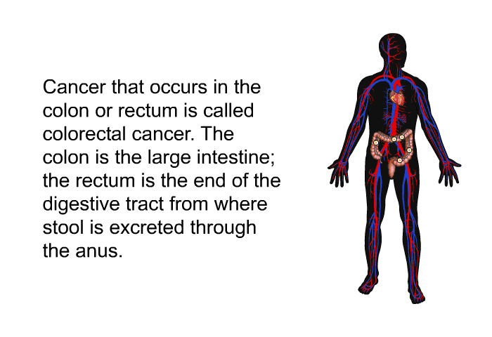 Cancer that occurs in the colon or rectum is called colorectal cancer. The colon is the large intestine; the rectum is the end of the digestive tract from where stool is excreted through the anus.