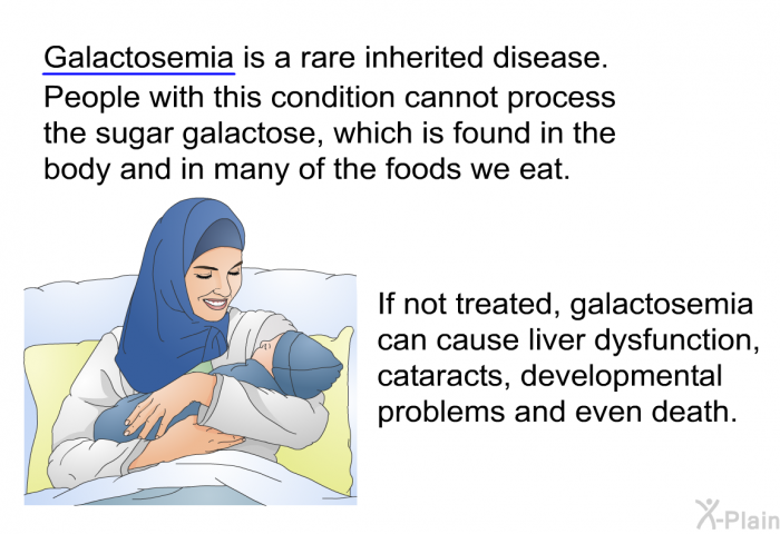 Galactosemia is a rare inherited disease. People with this condition cannot process the sugar galactose, which is found in the body and in many of the foods we eat. If not treated, galactosemia can cause liver dysfunction, cataracts, developmental problems and even death.