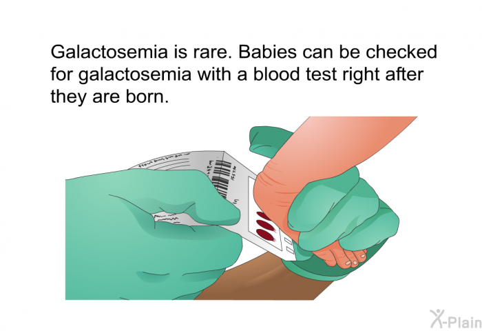 Galactosemia is rare. Babies can be checked for galactosemia with a blood test right after they are born.