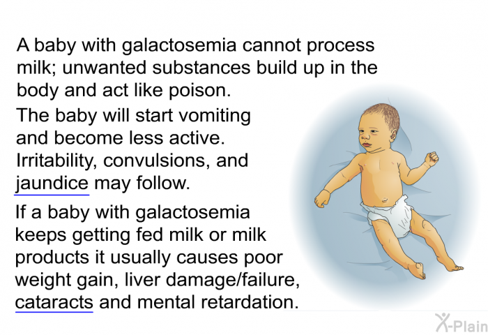 A baby with galactosemia cannot process milk; unwanted substances build up in the body and act like poison. The baby will start vomiting and become less active. Irritability, convulsions, and jaundice may follow. If a baby with galactosemia keeps getting fed milk or milk products it usually causes poor weight gain, liver damage/failure, cataracts and mental retardation.