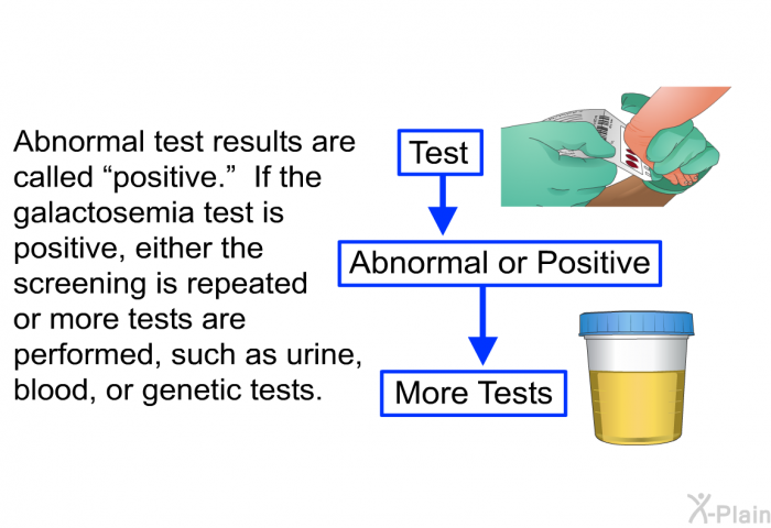 Abnormal test results are called “positive.” If the galactosemia test is positive, either the screening is repeated or more tests are performed, such as urine, blood, or genetic tests.