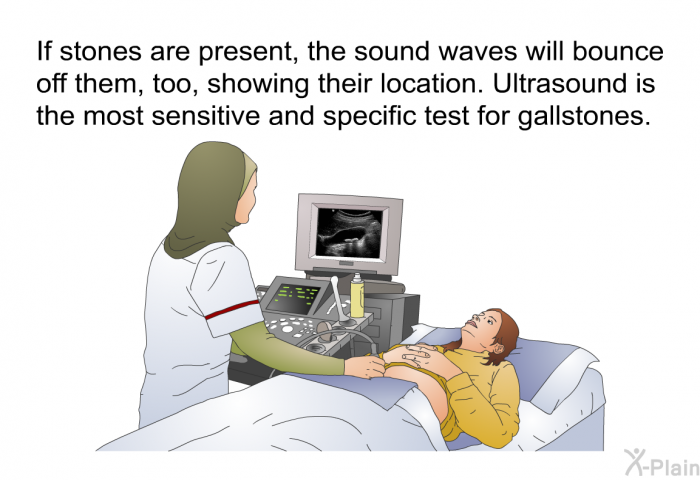 If stones are present, the sound waves will bounce off them, too, showing their location. Ultrasound is the most sensitive and specific test for gallstones.