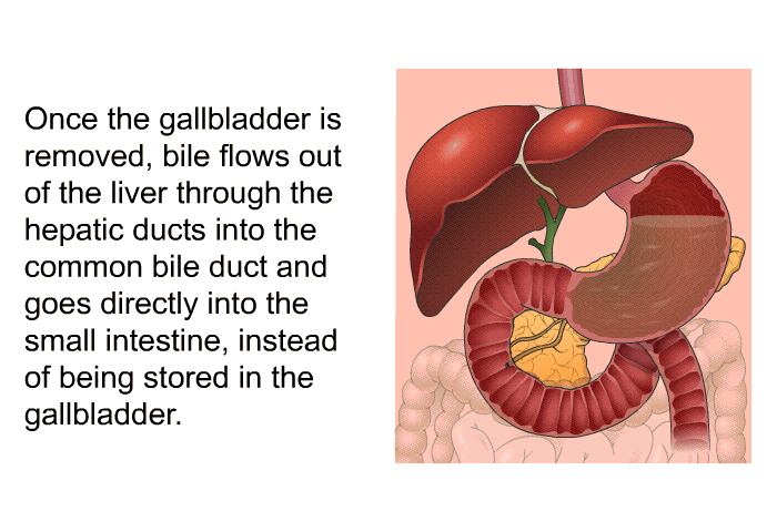 Once the gallbladder is removed, bile flows out of the liver through the hepatic ducts into the common bile duct and goes directly into the small intestine, instead of being stored in the gallbladder.