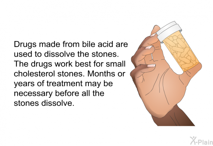 Drugs made from bile acid are used to dissolve the stones. The drugs work best for small cholesterol stones. Months or years of treatment may be necessary before all the stones dissolve.