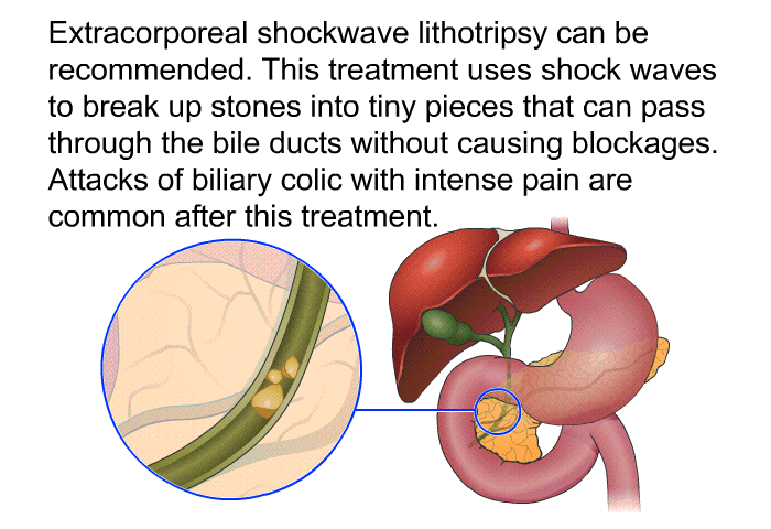 Extracorporeal shockwave lithotripsy can be recommended. This treatment uses shock waves to break up stones into tiny pieces that can pass through the bile ducts without causing blockages. Attacks of biliary colic with intense pain are common after this treatment.