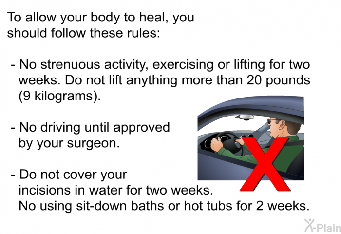 To allow your body to heal, you should follow these rules:  No strenuous activity, exercising or lifting for two weeks. Do not lift anything more than 20 pounds (9 kilograms). No driving until approved by your surgeon. Do not cover your incisions in water for two weeks. No using sit-down baths or hot tubs for 2 weeks.