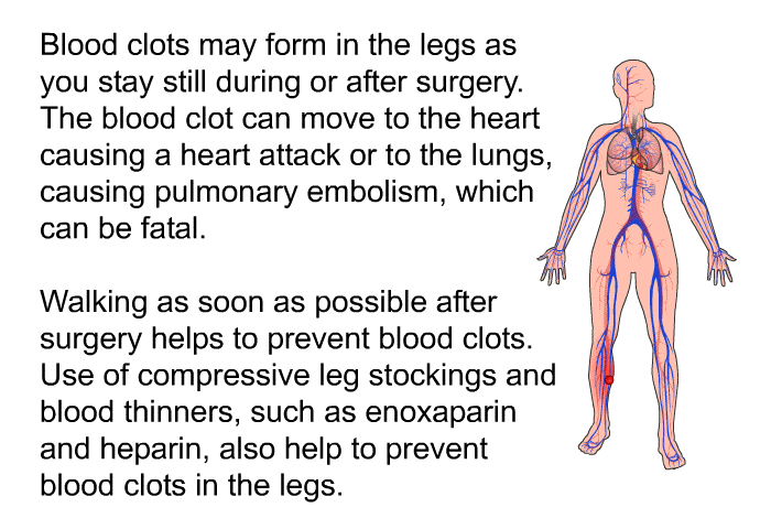 Blood clots may form in the legs as you stay still during or after surgery. The blood clot can move to the heart causing a heart attack or to the lungs, causing pulmonary embolism, which can be fatal. Walking as soon as possible after surgery helps to prevent blood clots.<B> </B>Use of compressive leg stockings and blood thinners, such as enoxaparin and heparin, also help to prevent blood clots in the legs.