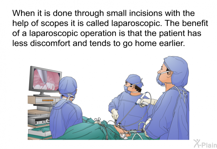 When it is done through small incisions with the help of scopes it is called laparoscopic. The benefit of a laparoscopic operation is that the patient has less discomfort and tends to go home earlier.