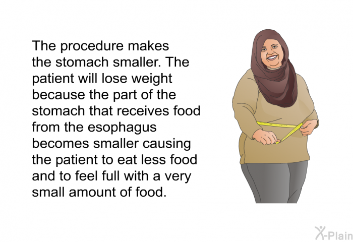 This procedure makes the stomach smaller. The patient will lose weight because the part of the stomach that receives food from the esophagus becomes smaller causing the patient to eat less food and to feel full with a very small amount of food.