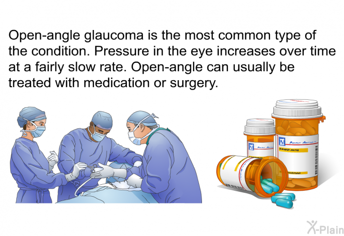 Open-angle glaucoma is the most common type of the condition. Pressure in the eye increases over time at a fairly slow rate. Open-angle can usually be treated with medication or surgery.