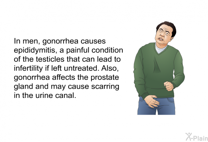 In men, gonorrhea causes epididymitis, a painful condition of the testicles that can lead to infertility if left untreated. Also, gonorrhea affects the prostate gland and may cause scarring in the urine canal.