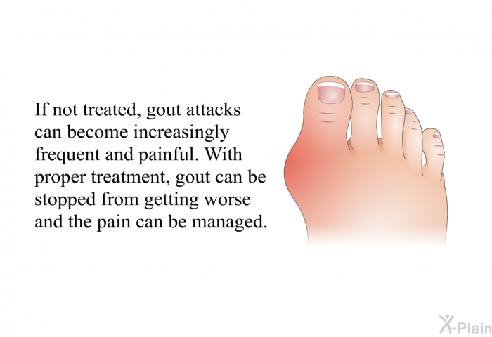 If not treated, gout attacks can become increasingly frequent and painful. With proper treatment, gout can be stopped from getting worse and the pain can be managed.
