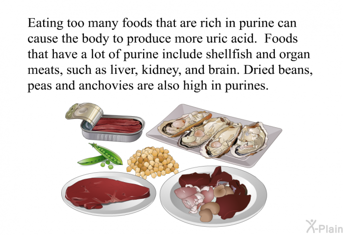 Eating too many foods that are rich in purine can cause the body to produce more uric acid. Foods that have a lot of purine include shellfish and organ meats, such as liver, kidney, and brain. Dried beans, peas and anchovies are also high in purines.