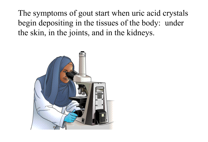 The symptoms of gout start when uric acid crystals begin depositing in the tissues of the body: under the skin, in the joints, and in the kidneys.